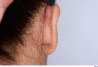 Hanane ear 0003.jpg